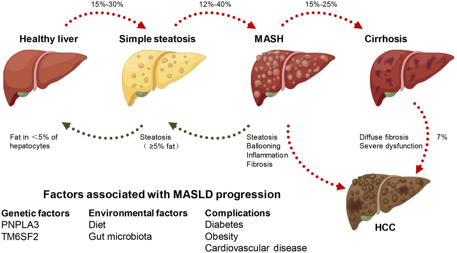 Spektrum tahapan penyakit fatty liver: dari hati sehat → steatosis → steatohepatitis → fibrosis → sirosis → karsinoma hepatoselular